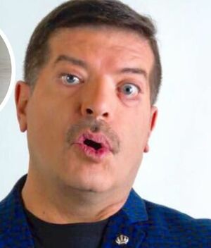 Pepe Magaña aclara la verdad detrás de su rostro golpeado (Instagram)