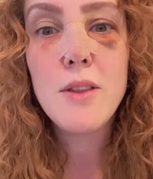 Famosa conductora y actriz se golpea el rostro con un cuadro (Foto: Instagram)