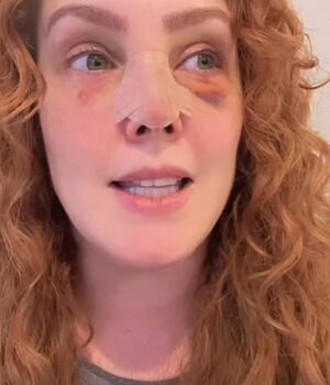 Famosa conductora y actriz se golpea el rostro con un cuadro (Foto: Instagram)