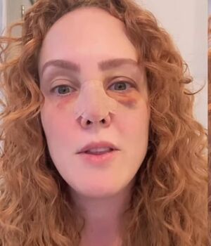 Famosa conductora y actriz se golpea el rostro con un cuadro (Foto: Instagram)