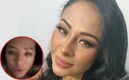 Toñita se somete a cirugía de ojos para “rejuvenecer”