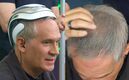 Arath de la Torre se somete a tratamiento contra la alopecia (Foto: Instagram)