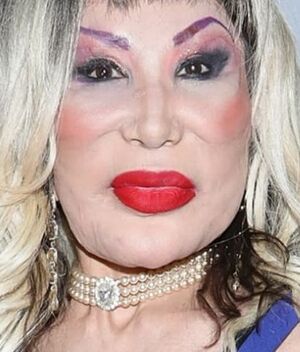 Lyn May rompe el silencio sobre la deformación de su rostro (Instagram)