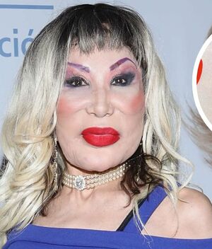 Lyn May rompe el silencio sobre la deformación de su rostro (Instagram)