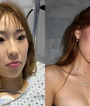 Influencer coreana denuncia estafa de hospital en CDMX (Instagram)