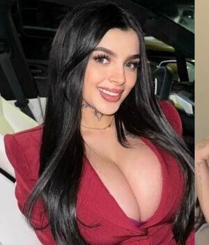 Karely Ruiz muestra su nueva cirugía estética en el pecho (Instagram)