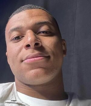 ¿Qué le pasó a Kylian Mbappé en la cara? Esto se sabe