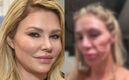 Brandi Glanville muestra tumor en su rostro por parásito  (Insatgram)