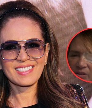 Yolanda Andrade alarma tras confirmar recaída de salud