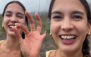 Influencer Ary Tenorio pierde un diente tras sufrir accidente (Foto: Instagram)