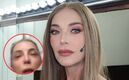 Laura Flores fue sometida a cirugía en el rostro, por esta razón