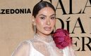 Galilea Montijo revela qué le pasó en su rostro tras cirugía estética