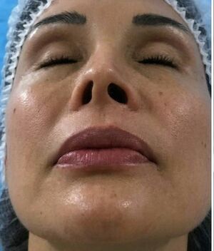 Tanya Vázquez se despide de 'Sale el Sol' tras sufrir mutilación en el rostro con un procedimiento estético (Foto: Redes Sociales)
