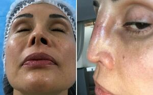 Tanya Vázquez se despide de 'Sale el Sol' tras sufrir mutilación en el rostro con un procedimiento estético (Foto: Redes Sociales)