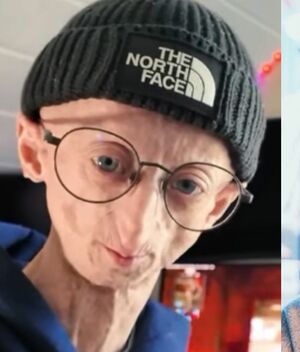Muere influencer Michiel Vandeweert tras luchar contra rara enfermedad