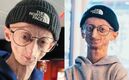 Muere influencer Michiel Vandeweert tras luchar contra rara enfermedad