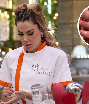 Ninel Conde sufre grave quemadura en 'Top Chef VIP 2026’ (Instagram)