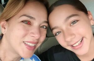 Adamari López preocupa por reaparecer con ojo inyectado en sangre  (Instagram)