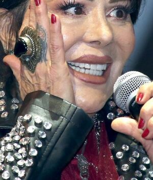 Alejandra Guzmán demandará tras safarse la cadera: ¿Qué pasó y por qué? (Foto: Mezcalent)