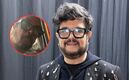 Aleks Syntek se quita su peluquín y aparece sin cabello