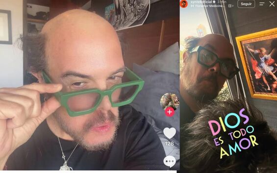 Aleks Syntek se quita su peluquín y aparece sin cabello