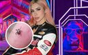 'La Granja VIP 2026': Alertan por plaga de garrapatas en el corral (Instagram)