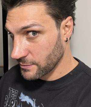 Nicola Porcella recibe burlas tras operación de nariz mal hecha (Foto: Instagram)