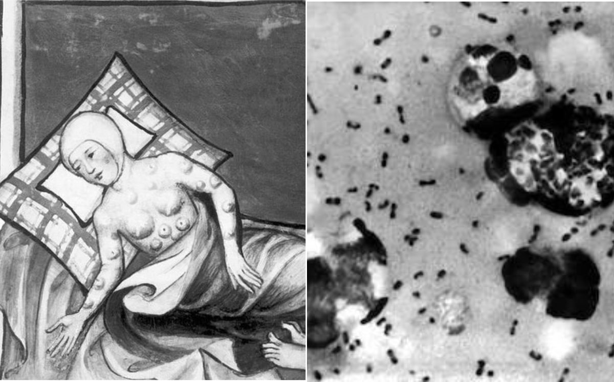 Peste neumónica: Conoce los síntomas de esta mortal enfermedad (Instagram)