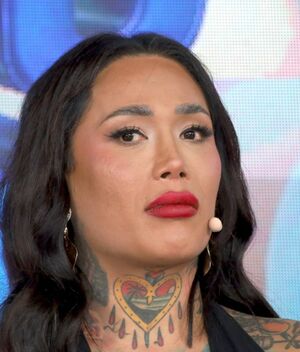 Karina Torres enfrenta complicaciones en su salud por biopolímeros