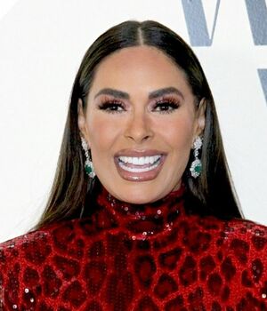 Galilea Montijo se somete a nuevo procedimiento estético en VIVO