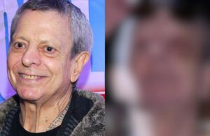 César Bono muestra cómo quedó su ojo tras cirugía por tumor (Mézcalent)